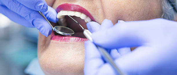 Best Knocked-Out Tooth Emergency  in Venice Gardens, FL